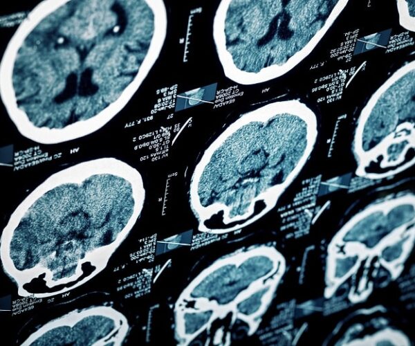 Donate to Brain Injury Alliance As Part of GiveBIG Campaign Donate to Brain Injury Alliance As Part of GiveBIG Campaign