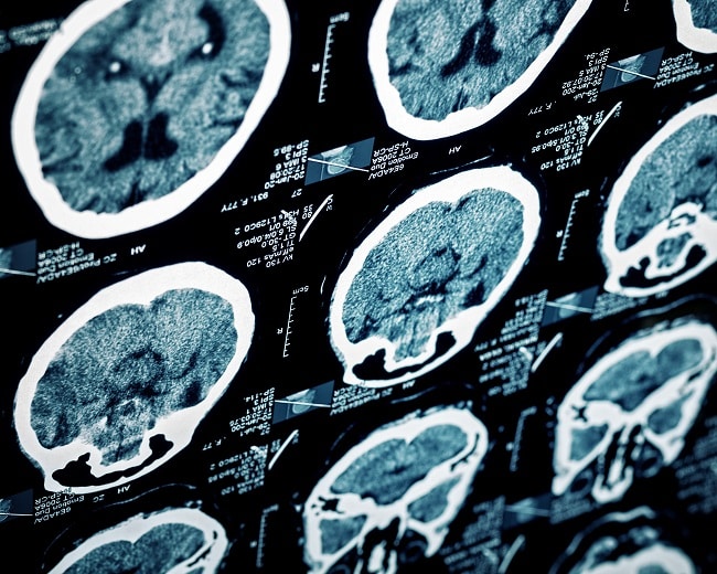 Brain Injury Alliance